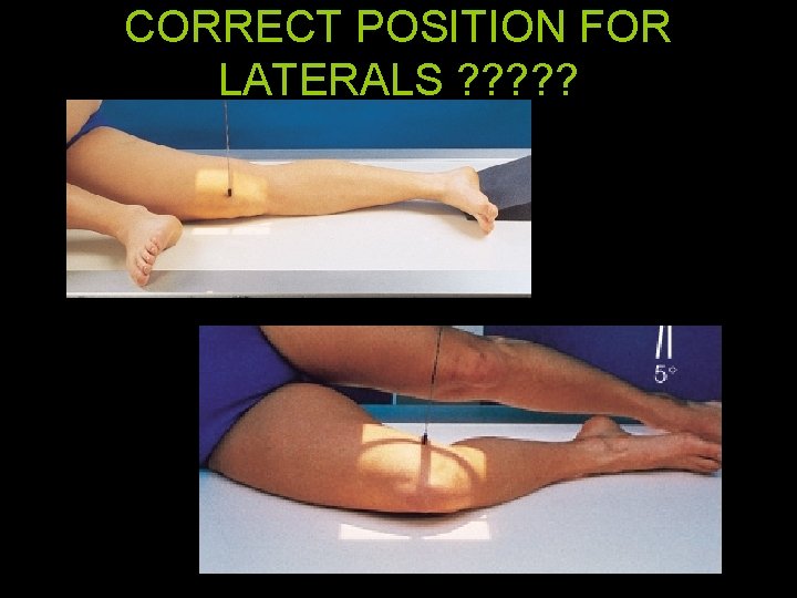 CORRECT POSITION FOR LATERALS ? ? ? 64 