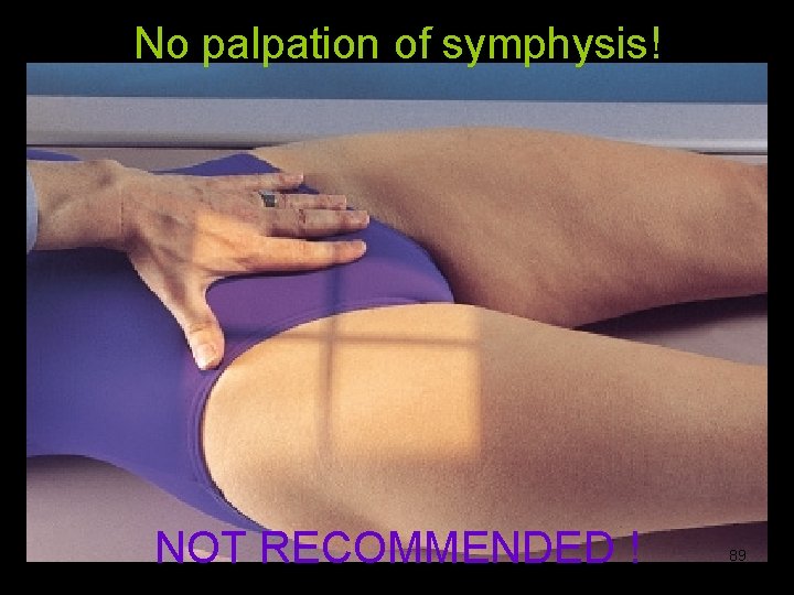 No palpation of symphysis! NOT RECOMMENDED ! 89 