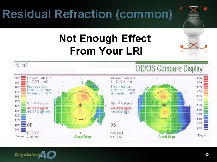 Residual Refraction (common) Not Enough Effect From Your LRI 33 