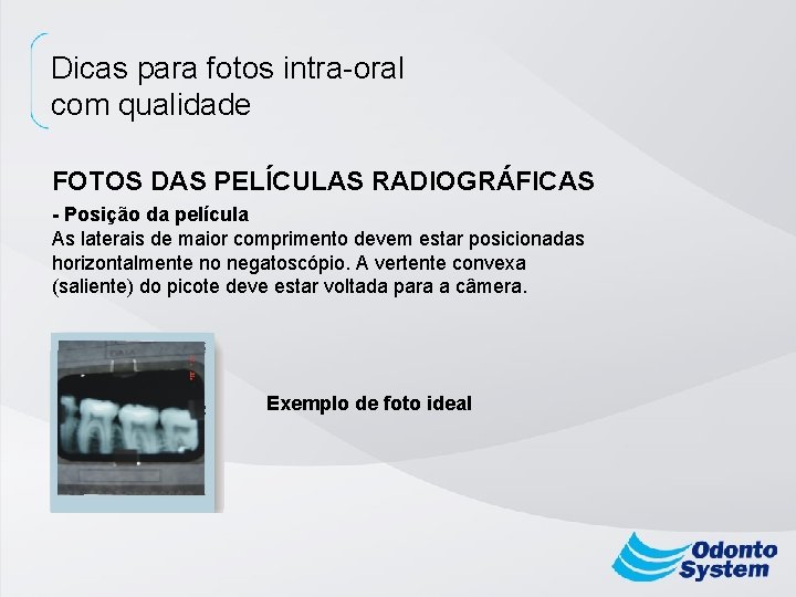 Dicas para fotos intra-oral com qualidade FOTOS DAS PELÍCULAS RADIOGRÁFICAS - Posição da película