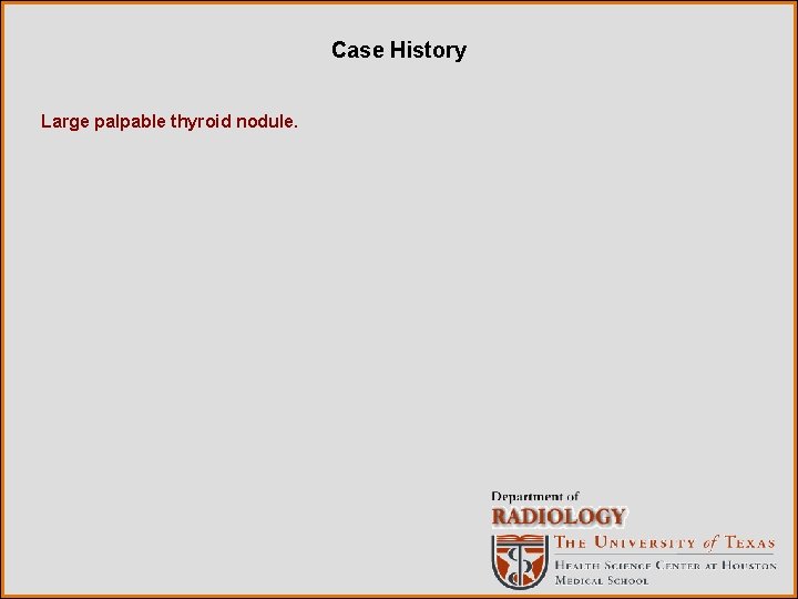 Case History Large palpable thyroid nodule. 