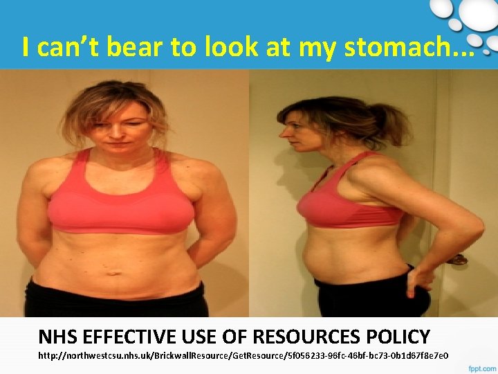 I can’t bear to look at my stomach. . . NHS EFFECTIVE USE OF