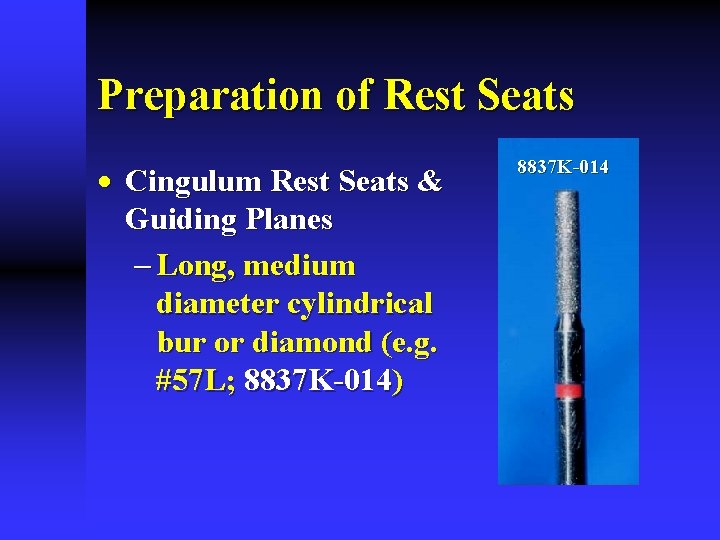 Preparation of Rest Seats · Cingulum Rest Seats & Guiding Planes - Long, medium