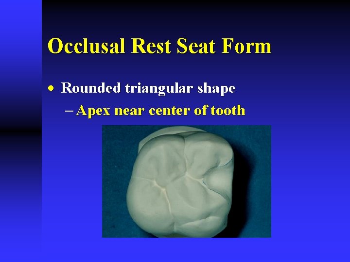 Occlusal Rest Seat Form · Rounded triangular shape - Apex near center of tooth Occlusal Rest Seat Form · Rounded triangular shape - Apex near center of tooth