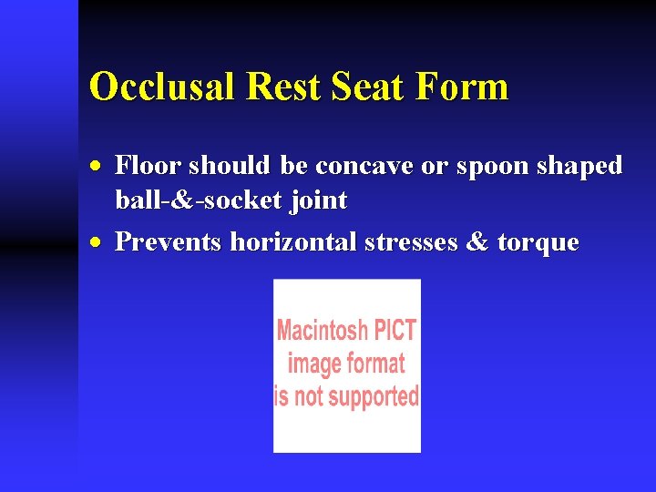 Occlusal Rest Seat Form · Floor should be concave or spoon shaped ball-&-socket joint