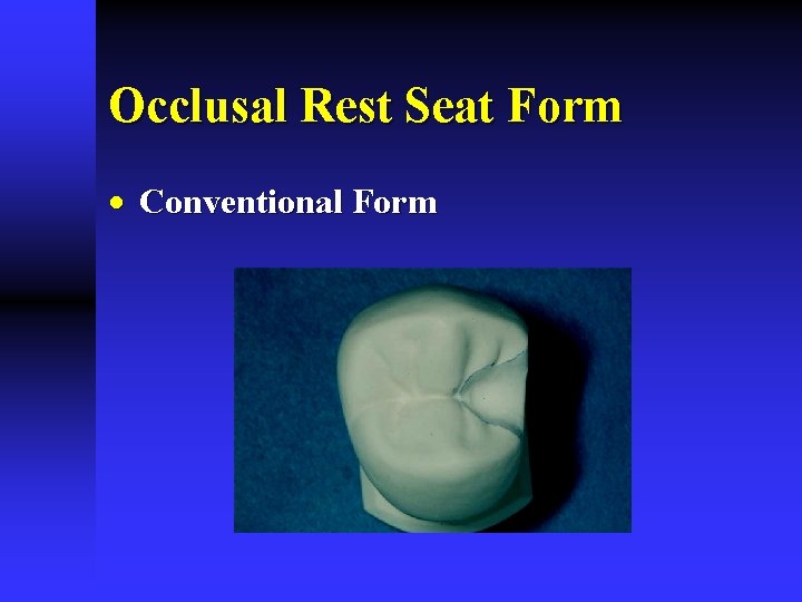Occlusal Rest Seat Form · Conventional Form 