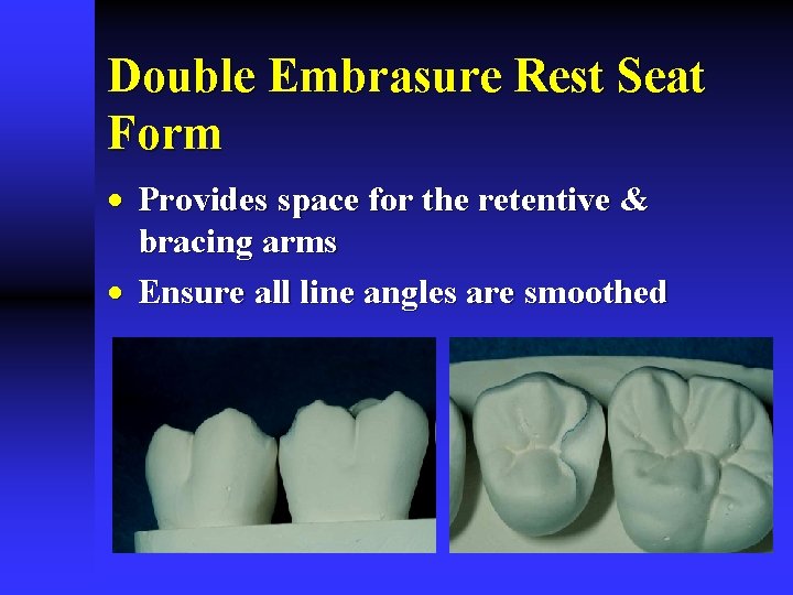 Double Embrasure Rest Seat Form · Provides space for the retentive & bracing arms