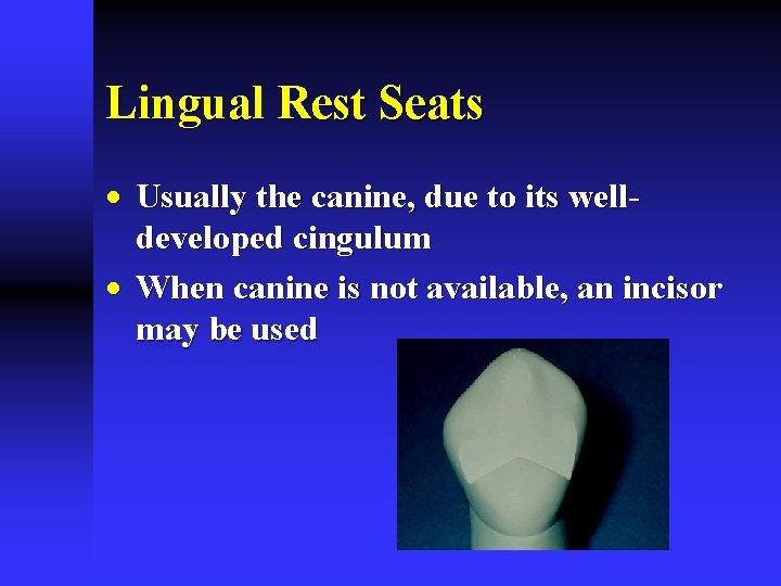 Lingual Rest Seats · Usually the canine, due to its welldeveloped cingulum · When Lingual Rest Seats · Usually the canine, due to its welldeveloped cingulum · When