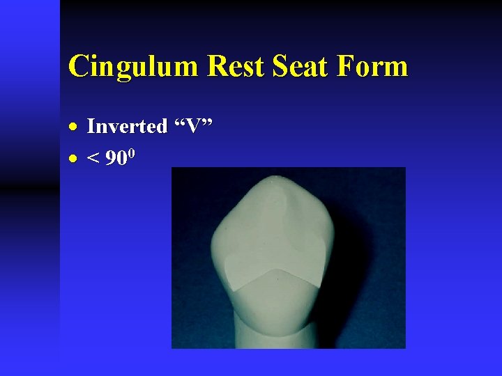 Cingulum Rest Seat Form · Inverted “V” · < 900 Cingulum Rest Seat Form · Inverted “V” · < 900