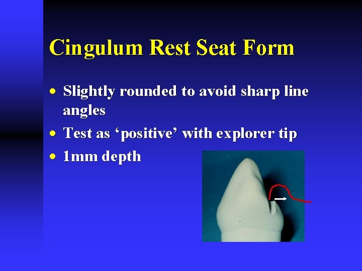 Cingulum Rest Seat Form · Slightly rounded to avoid sharp line angles · Test