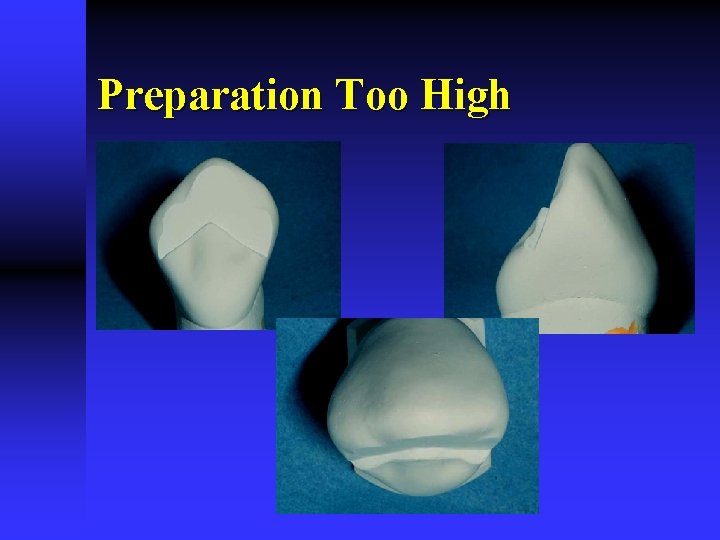 Preparation Too High Preparation Too High