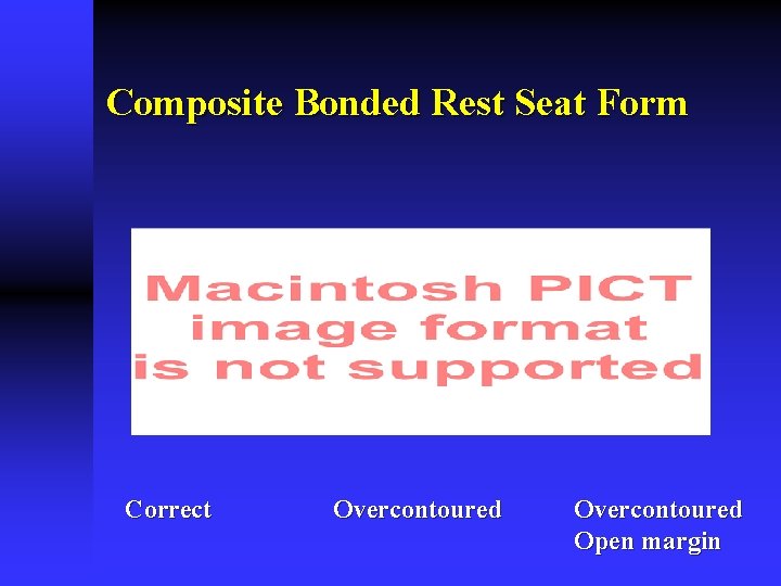 Composite Bonded Rest Seat Form Correct Overcontoured Open margin Composite Bonded Rest Seat Form Correct Overcontoured Open margin