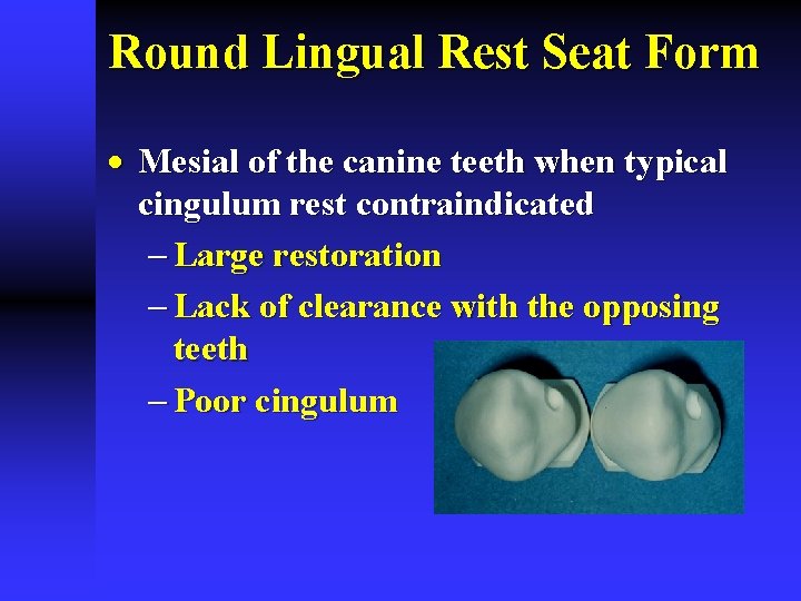 Round Lingual Rest Seat Form · Mesial of the canine teeth when typical cingulum