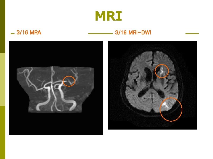 MRI 3/16 MRA 3/8 안동병원 MRI-DWI 3/16 MRI-DWI 