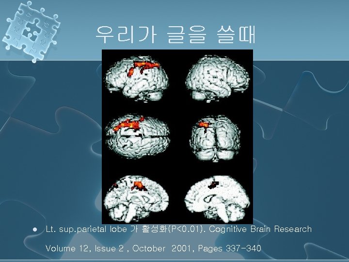 우리가 글을 쓸때 l Lt. sup. parietal lobe 가 활성화(P<0. 01). Cognitive Brain Research