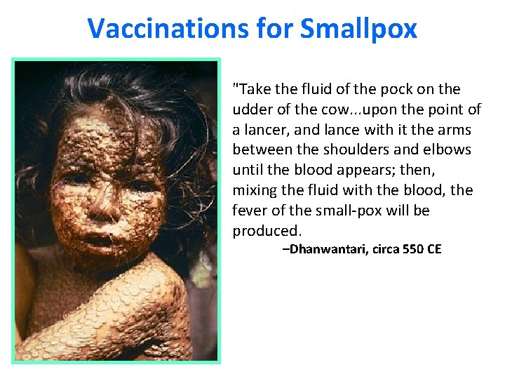 Vaccinations for Smallpox "Take the fluid of the pock on the udder of the Vaccinations for Smallpox "Take the fluid of the pock on the udder of the