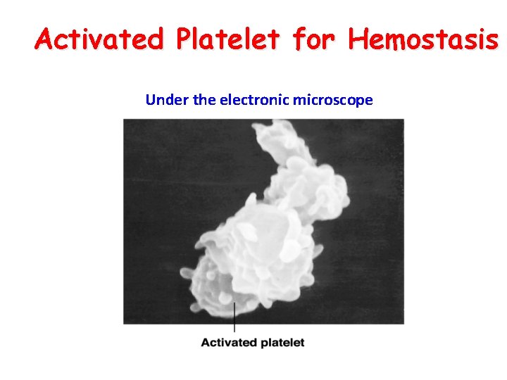 Activated Platelet for Hemostasis Under the electronic microscope 