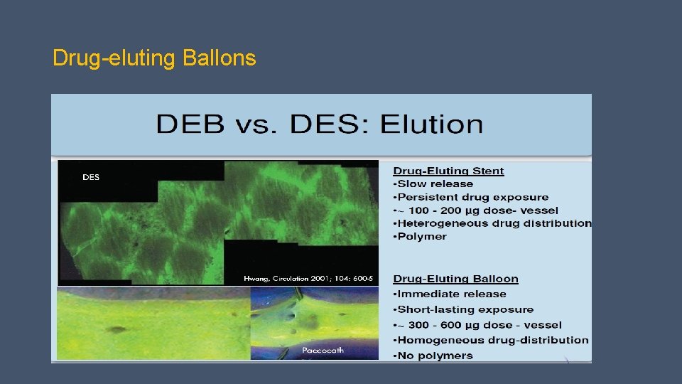 Drug-eluting Ballons 