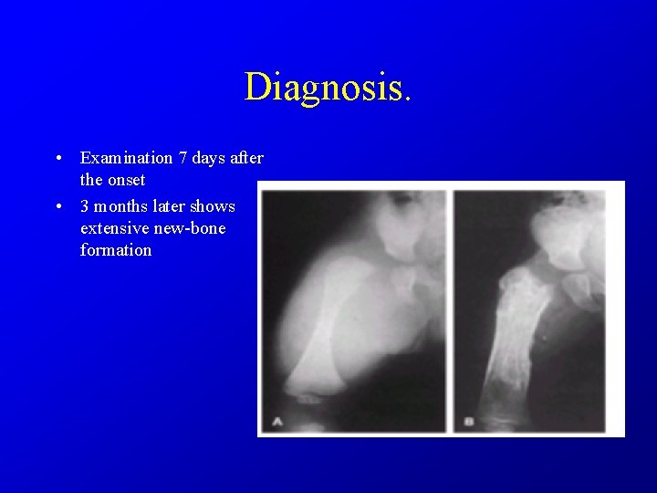 Diagnosis. • Examination 7 days after the onset • 3 months later shows extensive