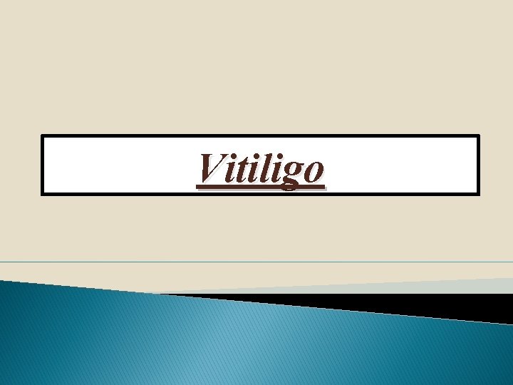 Vitiligo 