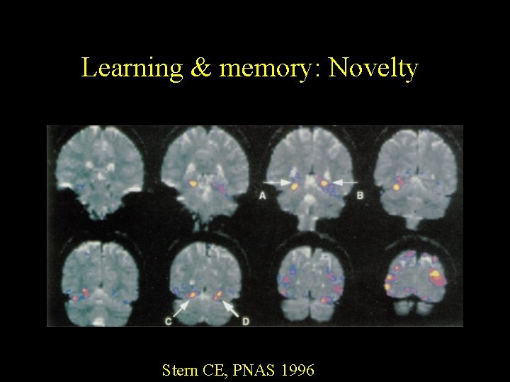 Learning & memory: Novelty Stern CE, PNAS 1996 