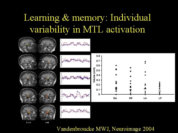 Learning & memory: Individual variability in MTL activation Vandenbroucke MWJ, Neuroimage 2004 