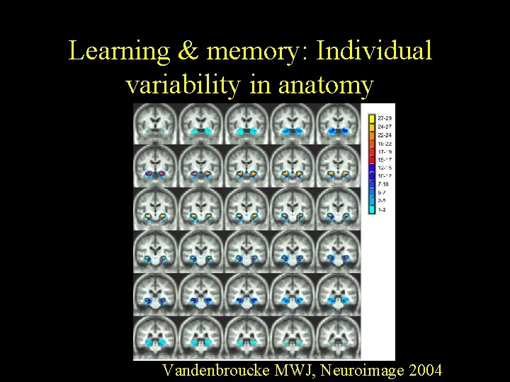 Learning & memory: Individual variability in anatomy Vandenbroucke MWJ, Neuroimage 2004 