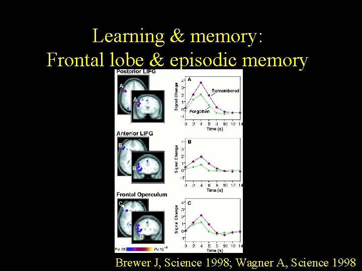 Learning & memory: Frontal lobe & episodic memory Brewer J, Science 1998; Wagner A,