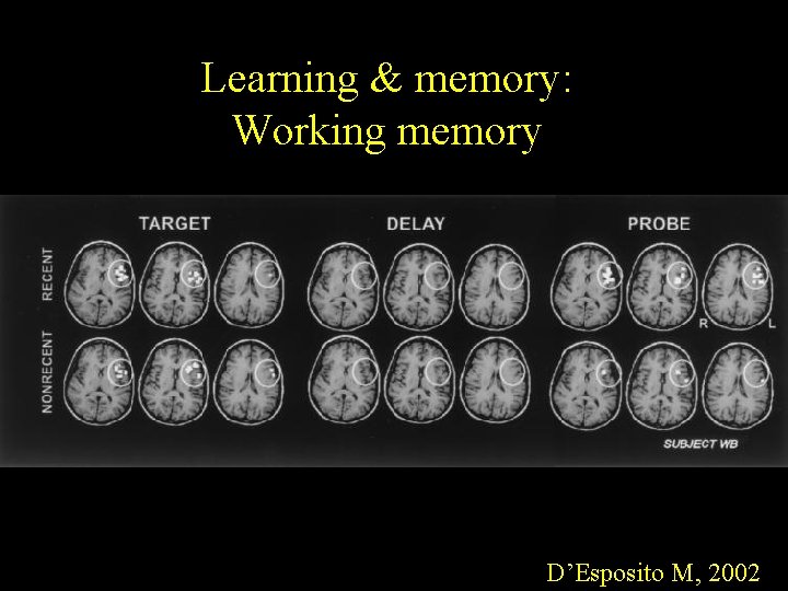 Learning & memory: Working memory D’Esposito M, 2002 