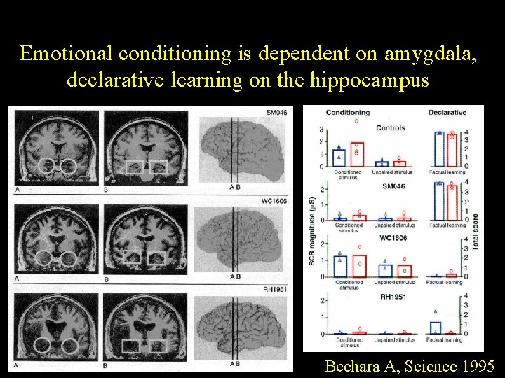 Emotional conditioning is dependent on amygdala, declarative learning on the hippocampus Bechara A, Science