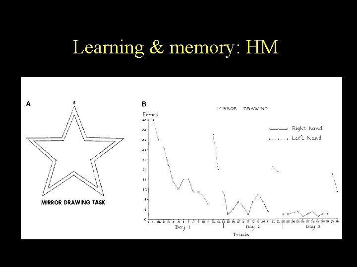 Learning & memory: HM 