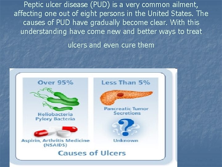 Peptic ulcer disease (PUD) is a very common ailment, affecting one out of eight