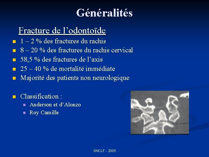 Généralités Fracture de l’odontoïde n 1 – 2 % des fractures du rachis 8