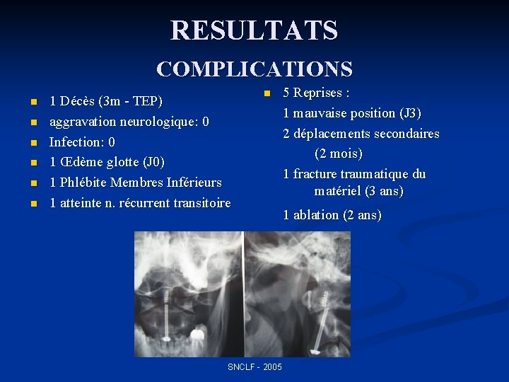 RESULTATS COMPLICATIONS n n n 1 Décès (3 m - TEP) aggravation neurologique: 0