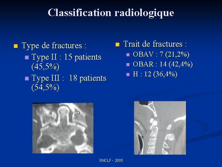 Classification radiologique n Type de fractures : n Type II : 15 patients (45,