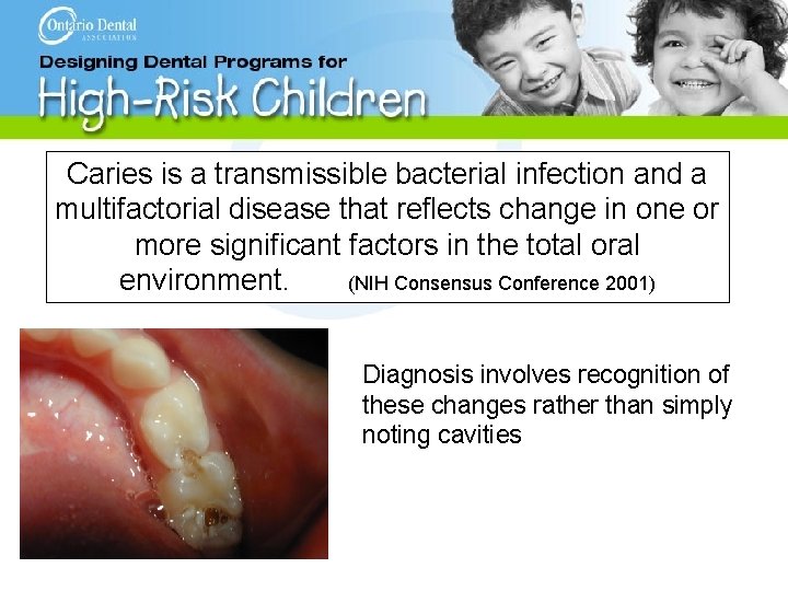 Caries is a transmissible bacterial infection and a multifactorial disease that reflects change in