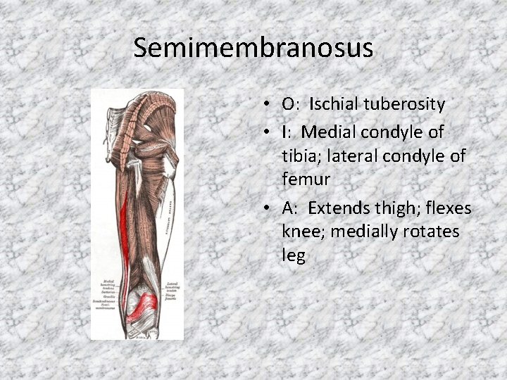 Semimembranosus • O: Ischial tuberosity • I: Medial condyle of tibia; lateral condyle of