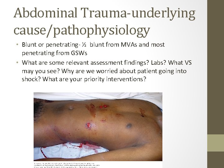 Abdominal Trauma-underlying cause/pathophysiology • Blunt or penetrating- ½ blunt from MVAs and most penetrating