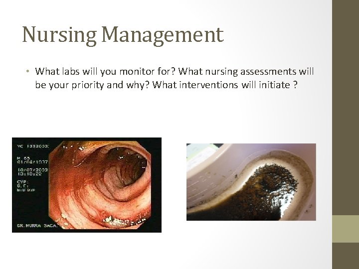 Nursing Management • What labs will you monitor for? What nursing assessments will be