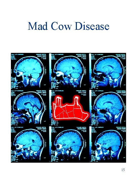 Mad Cow Disease 15 