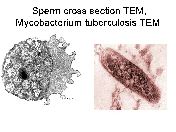  Sperm cross section TEM, Mycobacterium tuberculosis TEM 