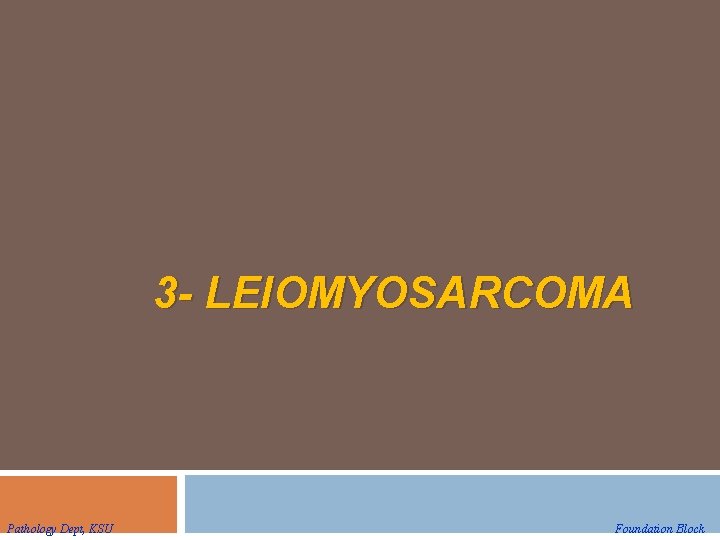 3 - LEIOMYOSARCOMA Pathology Dept, KSU Foundation Block 3 - LEIOMYOSARCOMA Pathology Dept, KSU Foundation Block