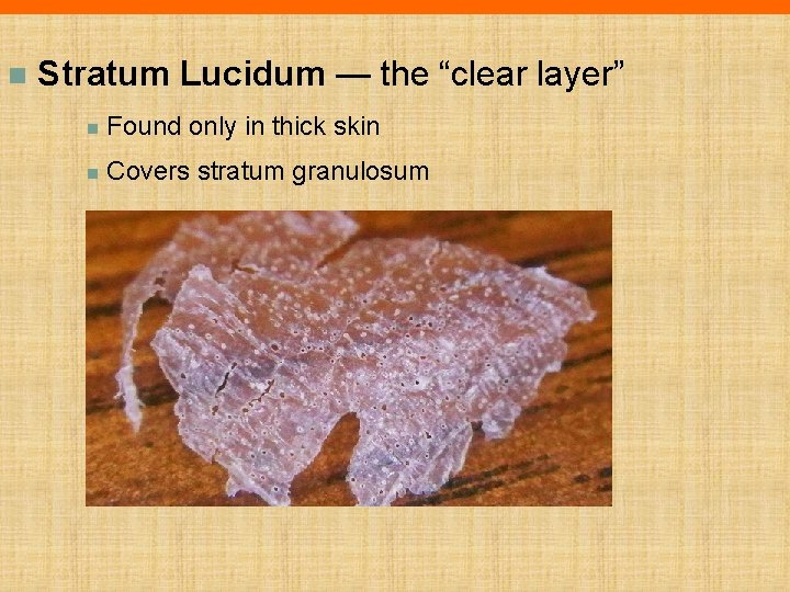 n Stratum Lucidum — the “clear layer” n Found only in thick skin n