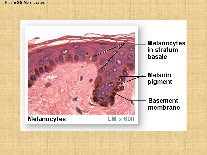 Figure 5 -5 Melanocytes in stratum basale Melanin pigment Basement membrane Melanocytes LM 600