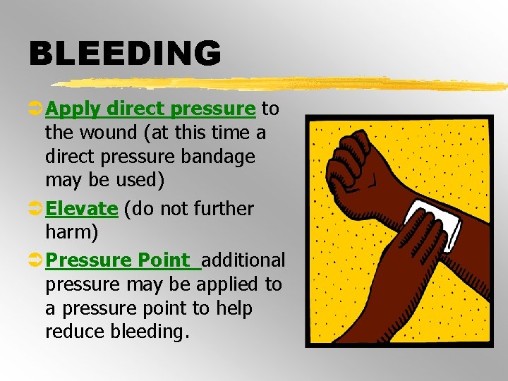 BLEEDING Ü Apply direct pressure to the wound (at this time a direct pressure BLEEDING Ü Apply direct pressure to the wound (at this time a direct pressure