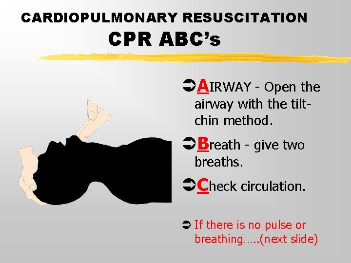 CARDIOPULMONARY RESUSCITATION CPR ABC’s ÜAIRWAY - Open the airway with the tiltchin method. ÜBreath CARDIOPULMONARY RESUSCITATION CPR ABC’s ÜAIRWAY - Open the airway with the tiltchin method. ÜBreath