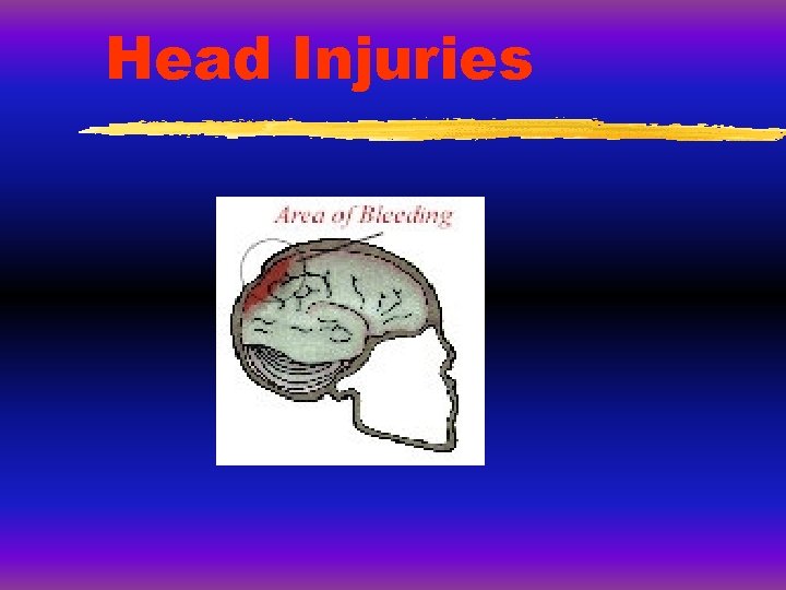 Head Injuries Head Injuries