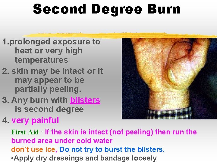 Second Degree Burn 1. prolonged exposure to heat or very high temperatures 2. skin Second Degree Burn 1. prolonged exposure to heat or very high temperatures 2. skin
