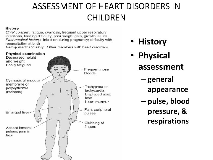 ASSESSMENT OF HEART DISORDERS IN CHILDREN • History • Physical assessment – general appearance