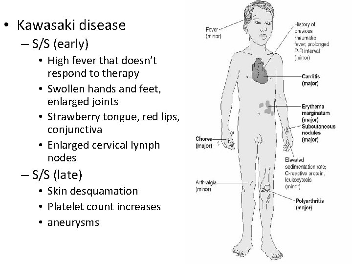  • Kawasaki disease – S/S (early) • High fever that doesn’t respond to